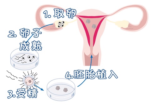 关于 代怀选性别包生男孩